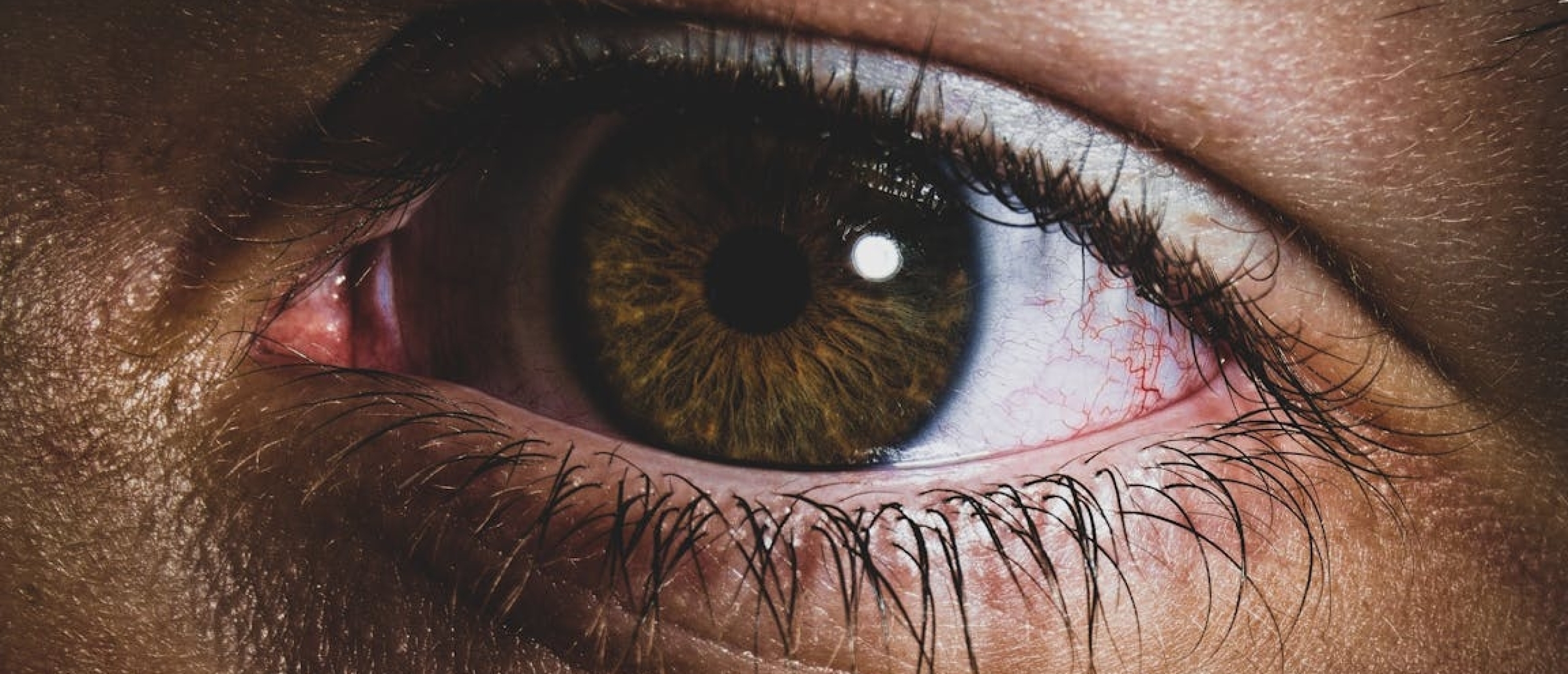 Hoe om te gaan met oogklachten? Tips en advies voor verschillende oogproblemen, gezondheid.nl
