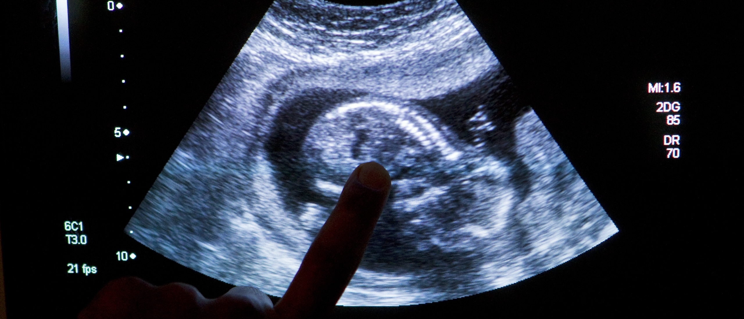 Rechtsfilosoof: fundamenteel debat nodig over embryo-onderzoek