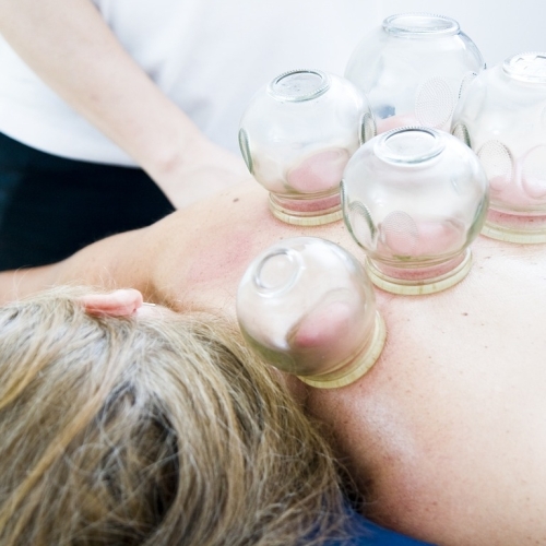 Cupping massage