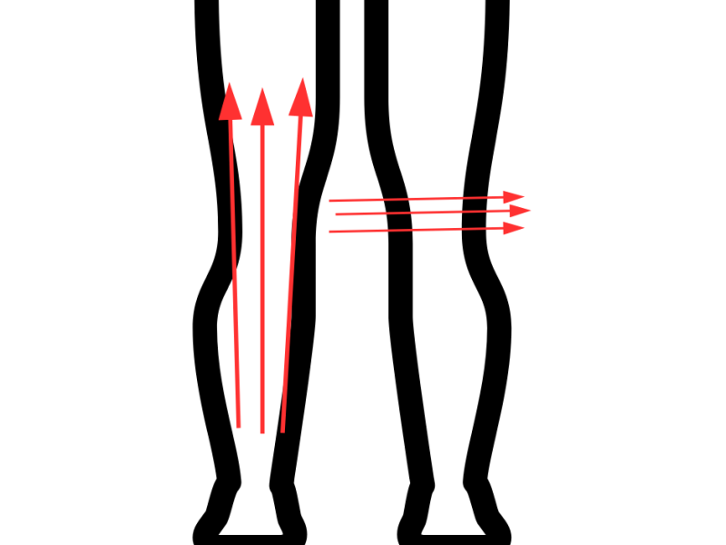 Vacuum Bodydrainer voor de benen