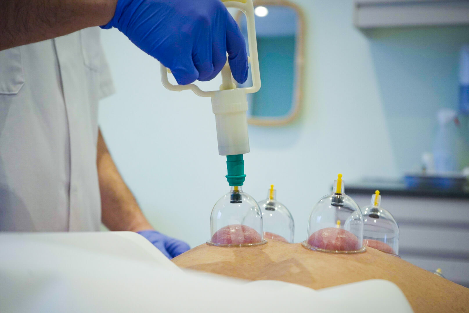 Wat is hijama?