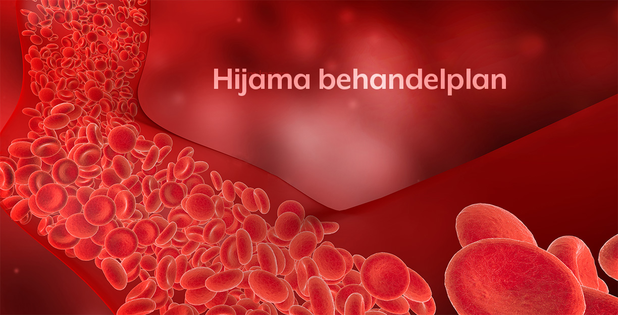 Hoe werkt Hijama behandeling