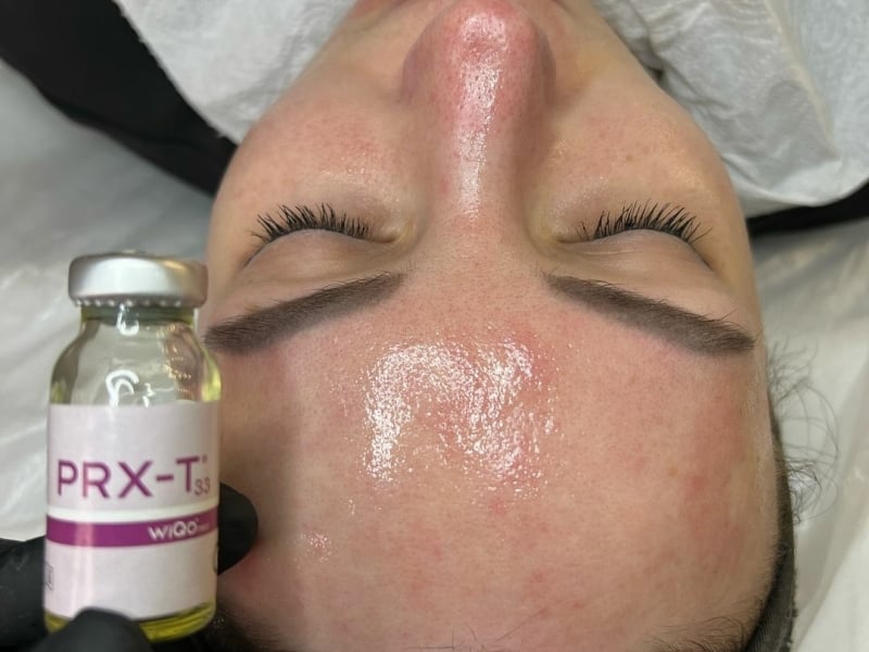 Huidverbetering Arnhem