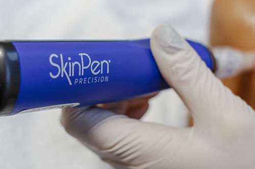 Boek bij ons een SkinPen behandeling