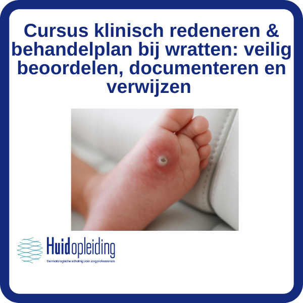 Cursus klinisch redeneren & behandelplan bij wratten: veilig beoordelen, documenteren en verwijzen
