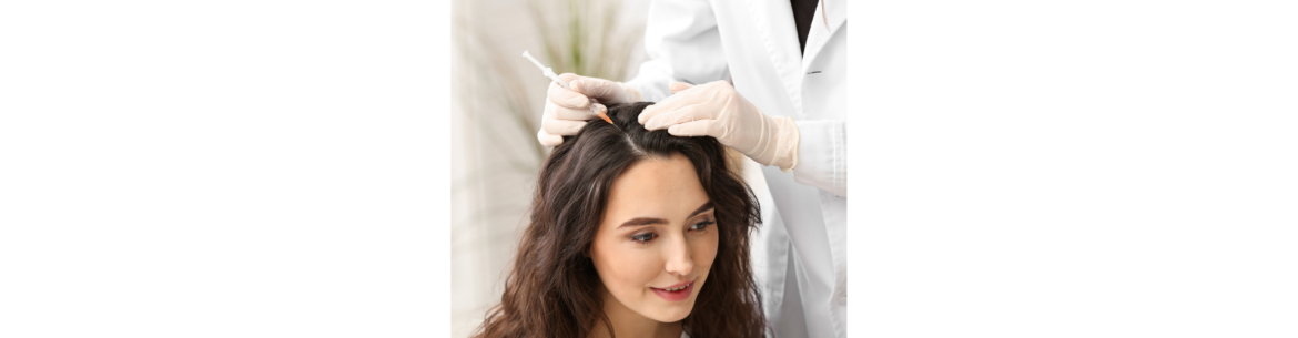 Alopecia areata voor hoofdhuidprofessionalsv
