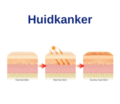 cursussen huidopleiding.nl