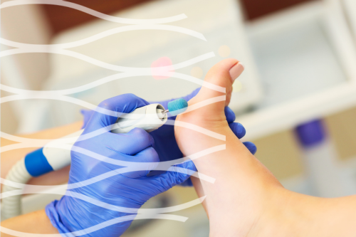 Medisch pedicures en pedicures met verdieping Podotherapeuten die regelmatig huid/nagelafwijkingen zien