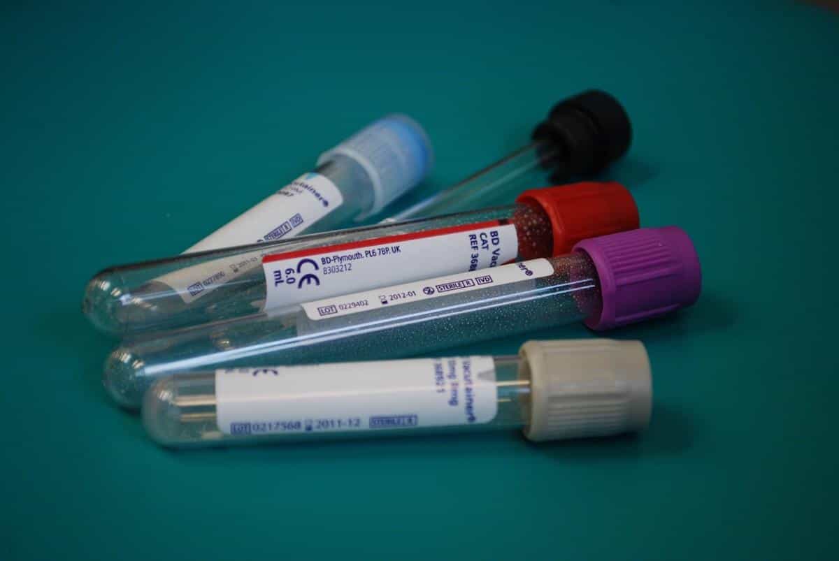 Cholesterol: van vijand naar vriend
