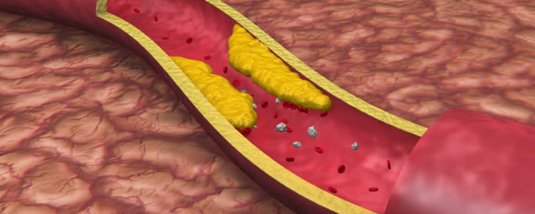 What you should know about your blood cholesterol levels