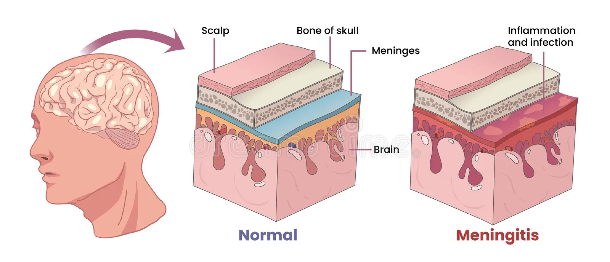 Membranen