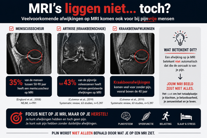 Kniepijnvrij - los de pijn in je knie op