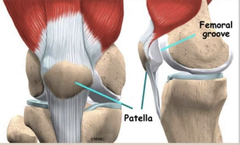 Los kniepijn snel en effectief op met Kniepijnvrij