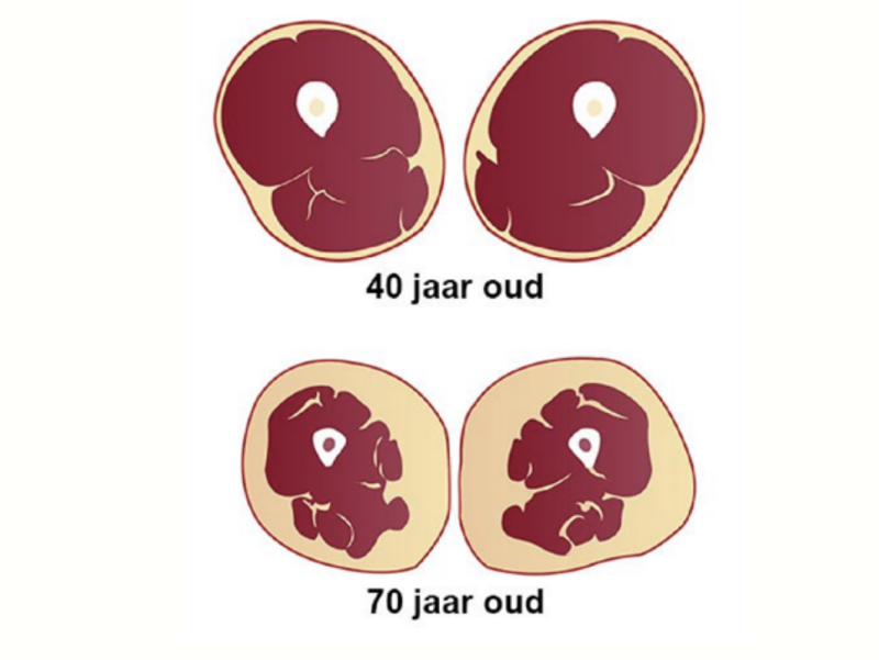 Kniepijnvrij - los de pijn in je knie op