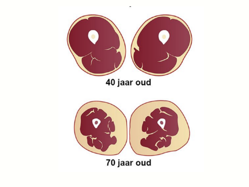 Kniepijnvrij - los de pijn in je knie op