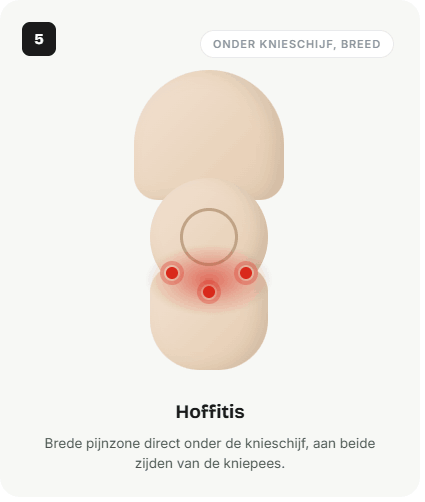 Pijn: breed, direct onder de knieschijf