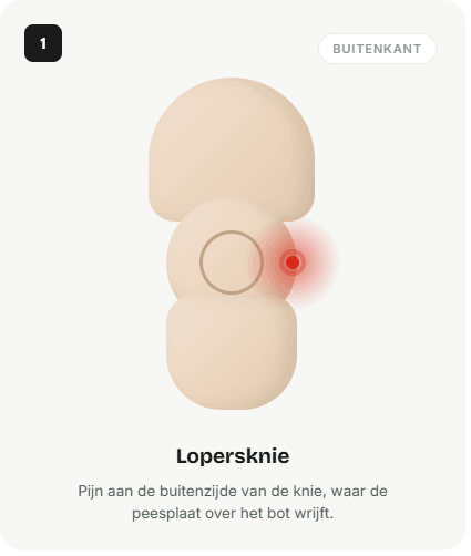 Pijn: buitenkant van de knie