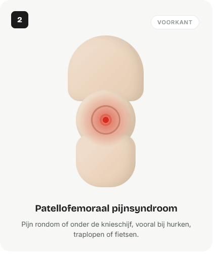 Pijn: rondom / onder de knieschijf