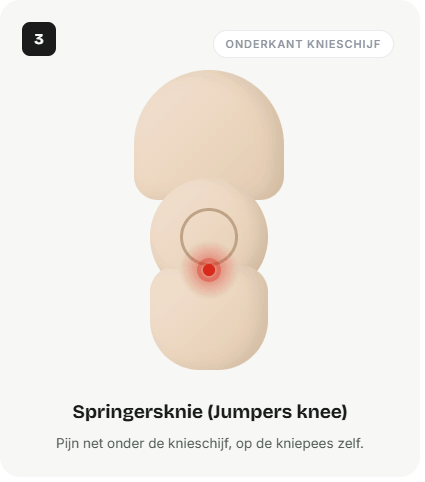 Pijn: net onder de knieschijf (kniepees)
