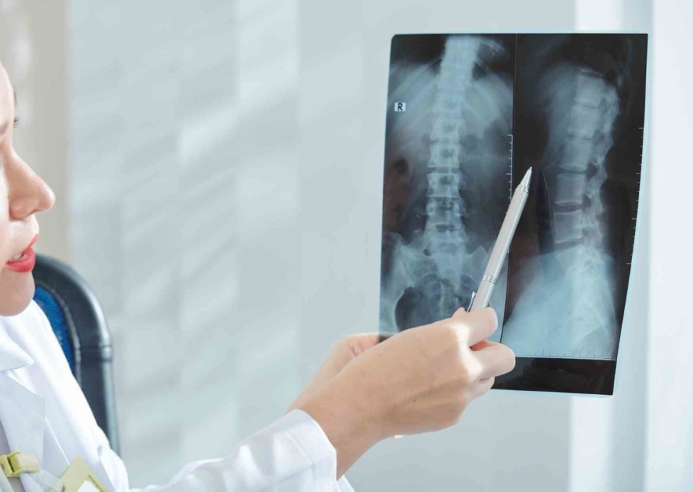 Rontgenfoto Lage Rug? Wanneer WEL/NIET? | Door de Lage Rugpijn Fysio