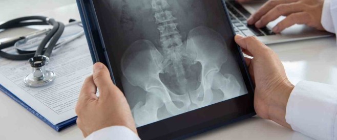 Rontgenfoto Lage Rug? Wanneer WEL/NIET? | Door de Lage Rugpijn Fysio