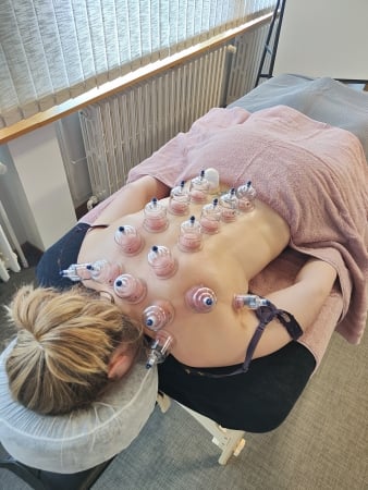 cupping massage