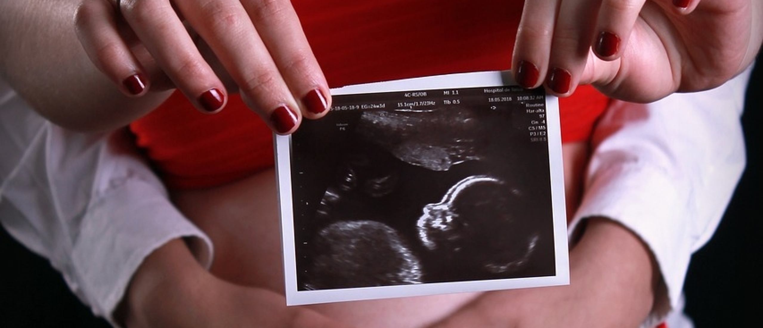 3D vs. 4D echo: wat is het verschil en wat kies jij?