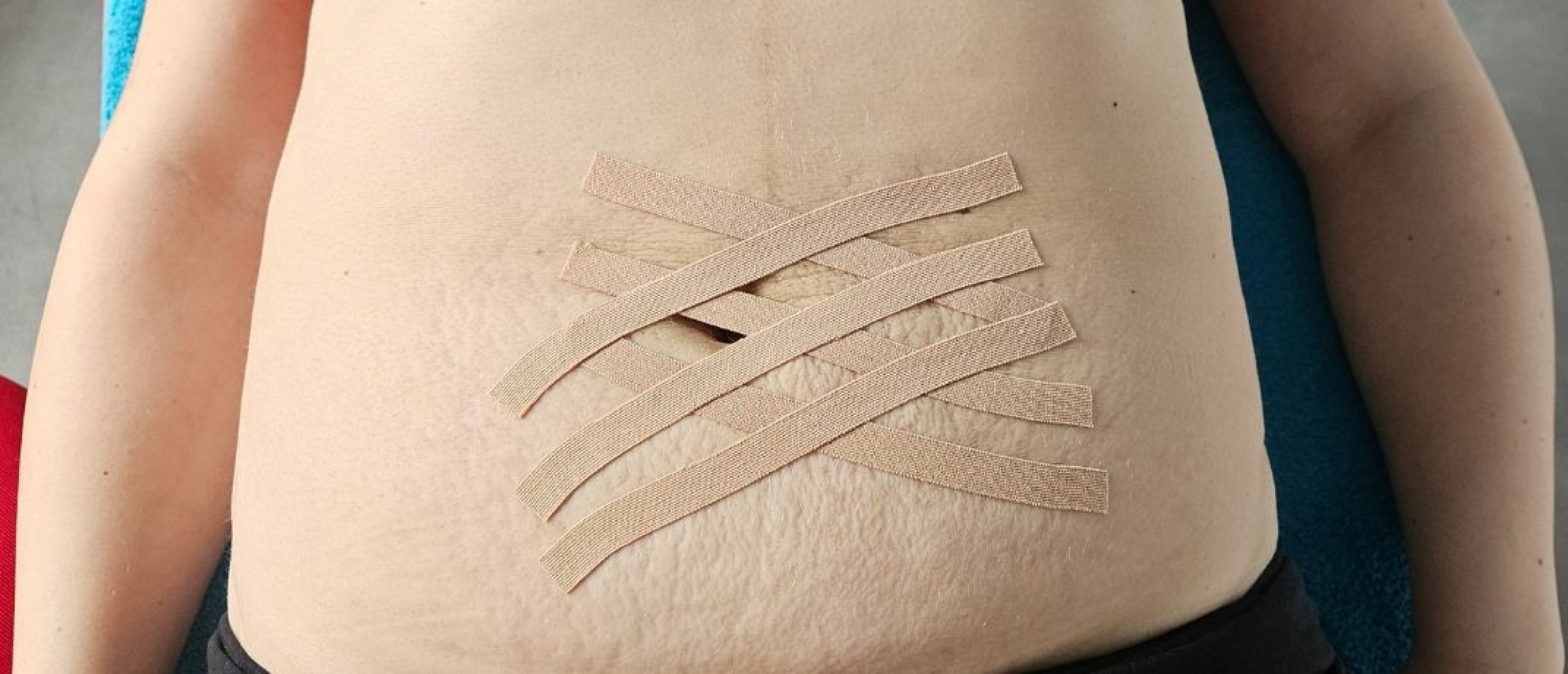 Buikspieren herstel na zwangerschap Buikspieren herstel na zwangerschap