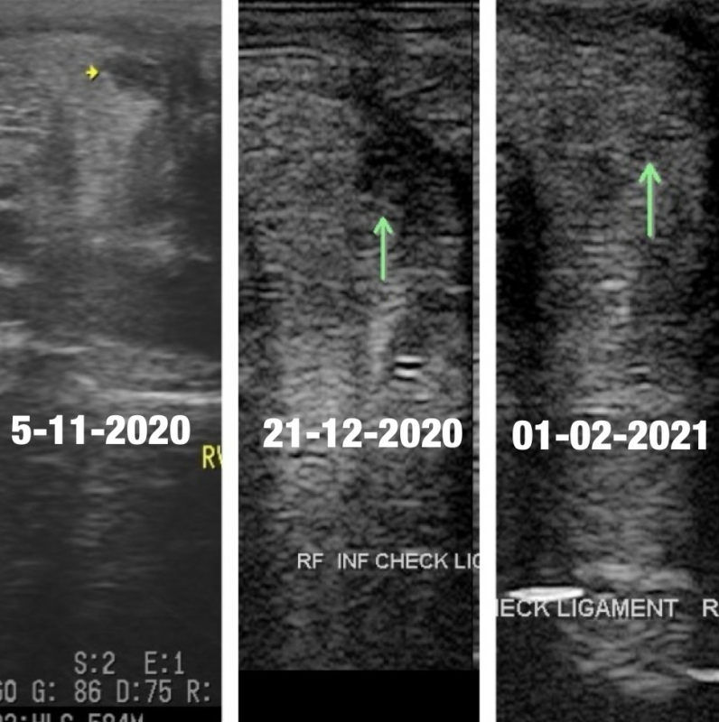 scans-checkligament