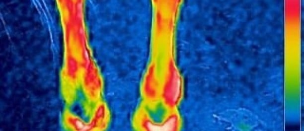 warmtebeelden voor en na magneetveldtherapie