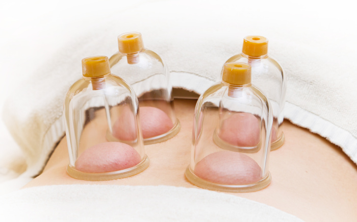 cursus cupping massage studie cupping