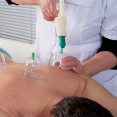 studie Cupping massage