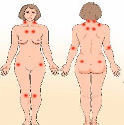cursus Fibromyalgie massage
