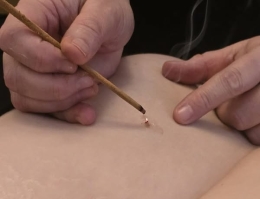 geef moxa therapie