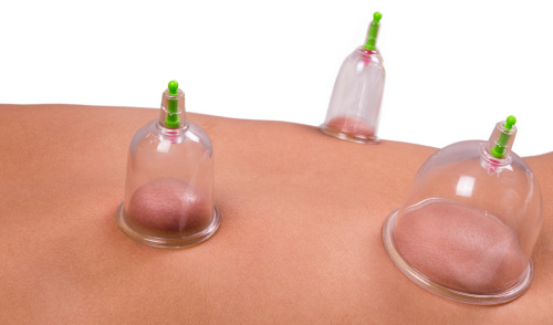 Cupping massage.