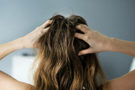 vrouw-hoofdpijn-bruin haar