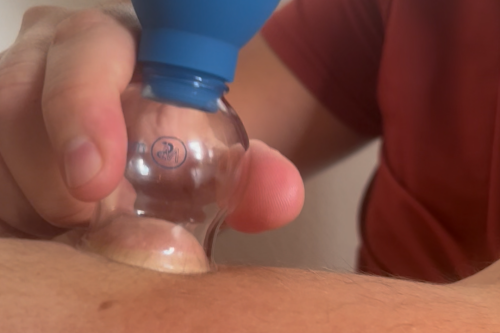 Transformational Cupping