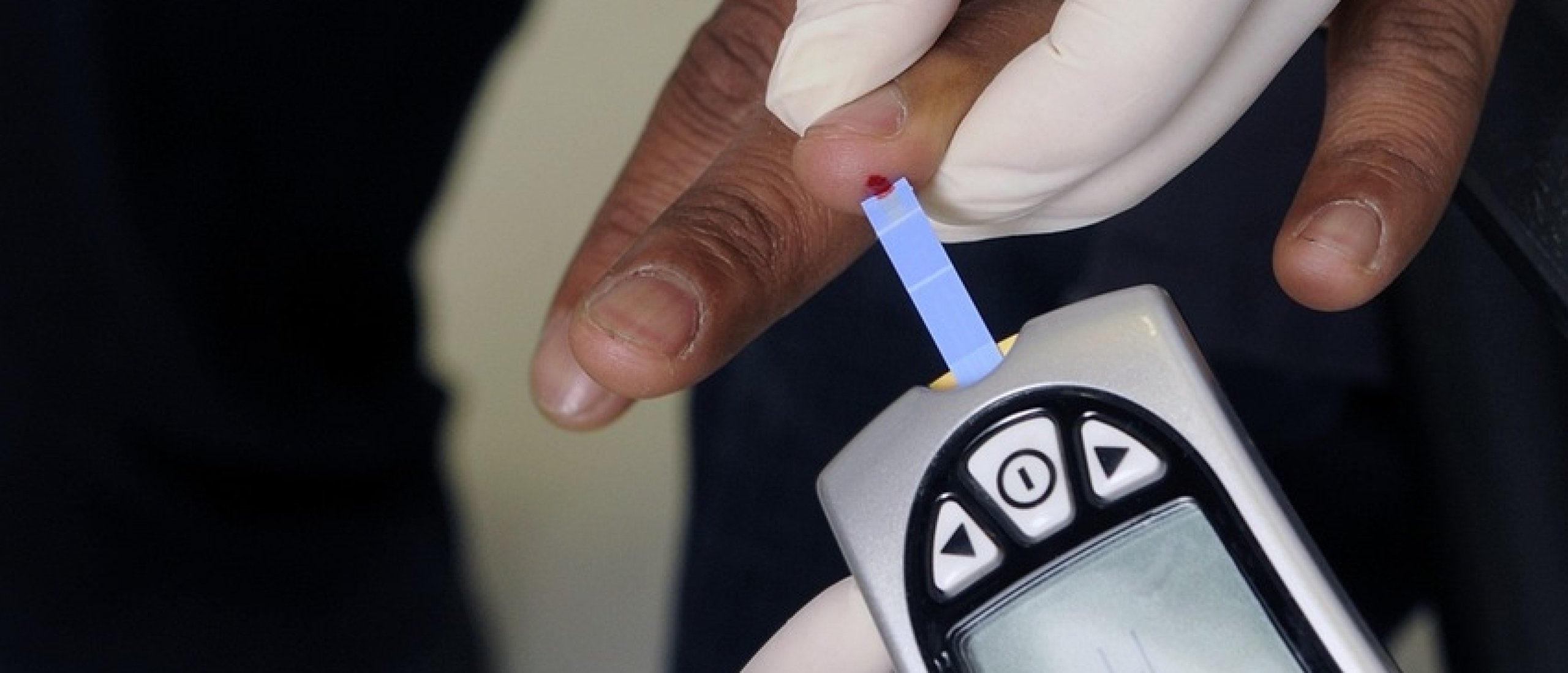 Cholesterol measurement