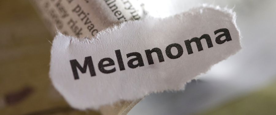 melanoma