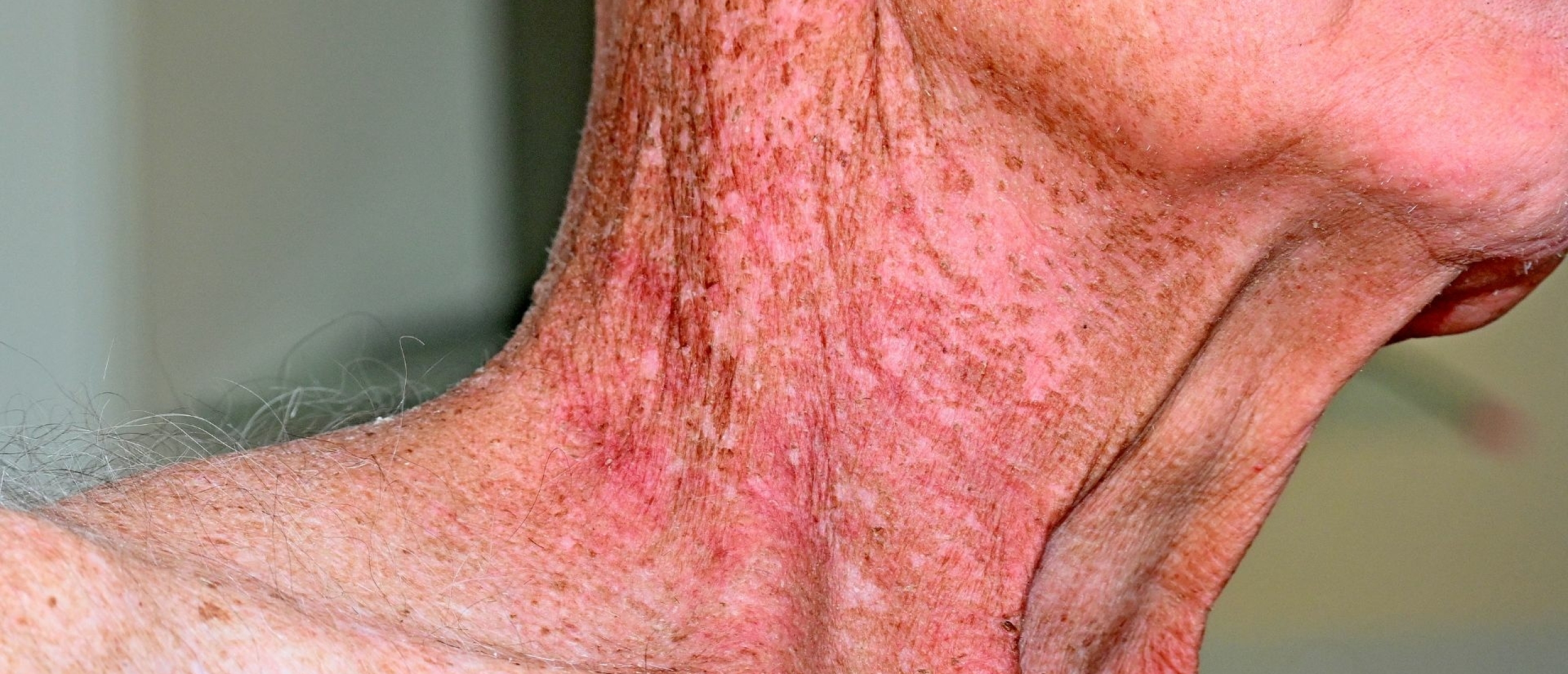 Dingen om te onthouden over HVS