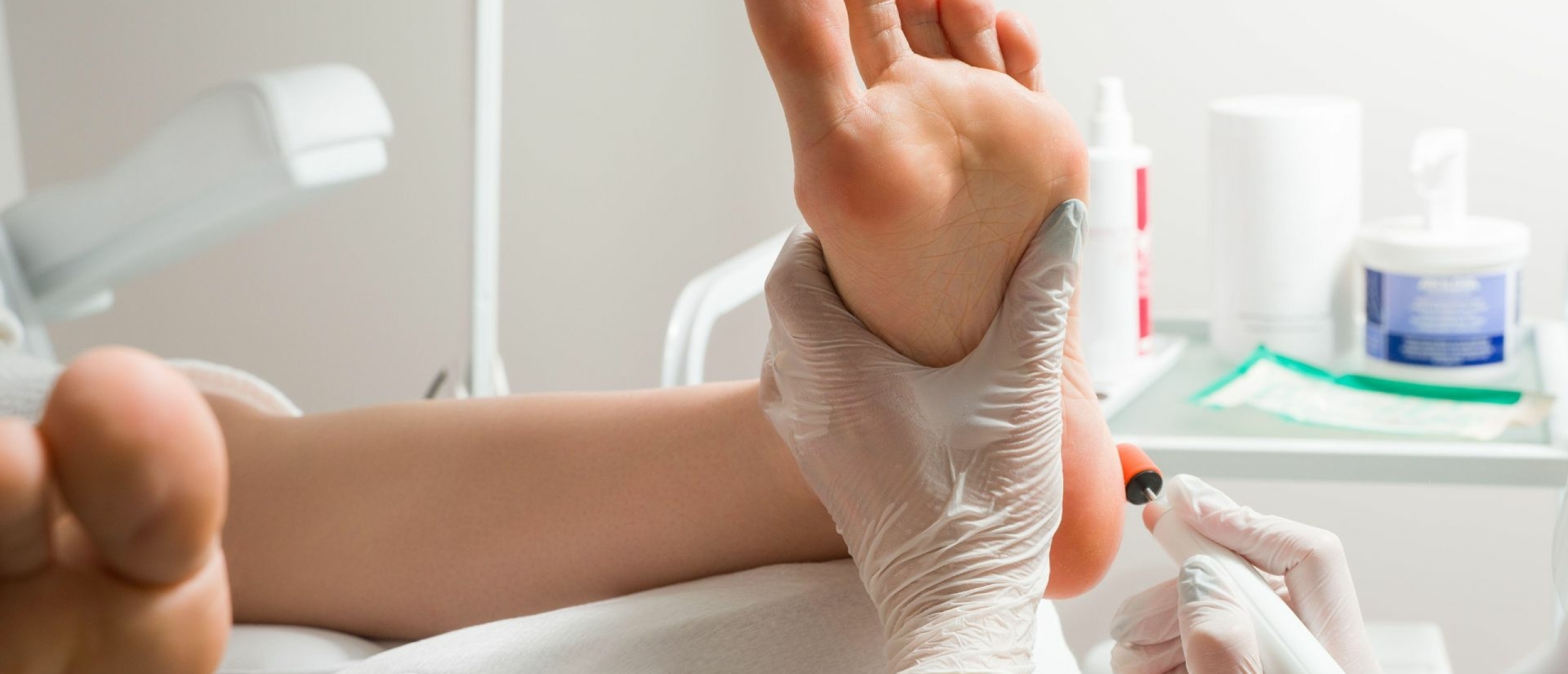 Huidafwijkingen aan de handen en de voeten door doelgerichte therapie HVHR