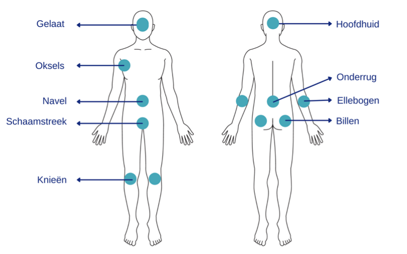 Psoriasis – Vormen en diagnose helder uitgelegd