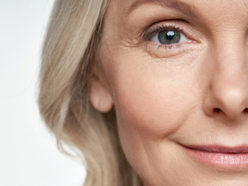 Ooglidcorrectie Arnhem Ooglidcorrectie Arnhem