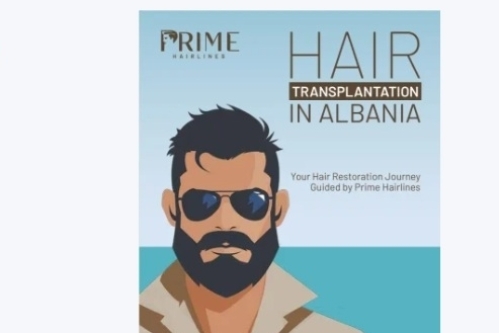 Real patient results following a personalised DHI hair transplant treatment.