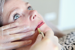 bioskinjetting bovenlip natuurlijke rimpel behandeling