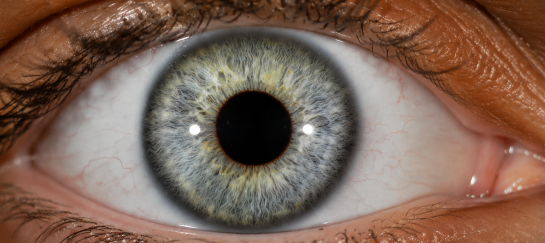 Close-up van een irisfoto van een oog, gebruikt als ondersteuning binnen de iriscopie om inzicht te krijgen in het lichaam en de natuurlijke balans.