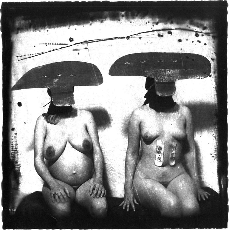 Joel-Peter Witkin 2 Women With Stomach Irritations