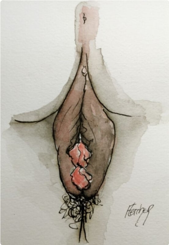 Stephen Fletcher, Marion Vi Dessin