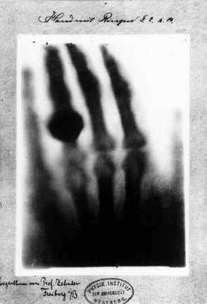 Wim Delvoye: The first x-ray image of knuckles by Röntgen, 