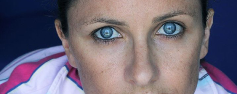 Skinlight vermindert hyperpigmentatie